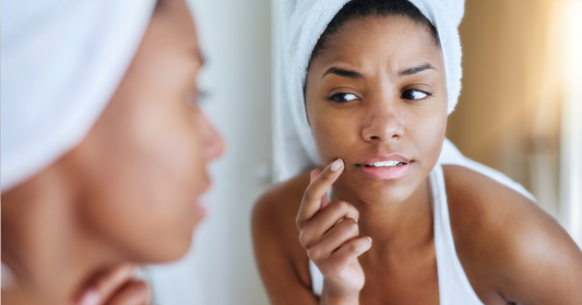 Breakouts after dermaplaning - causes and prevention