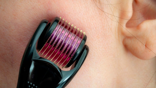 What is Microneedling and Why Do you Need It
